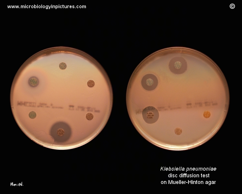 Klebsiella pneumoniae ESBL positive